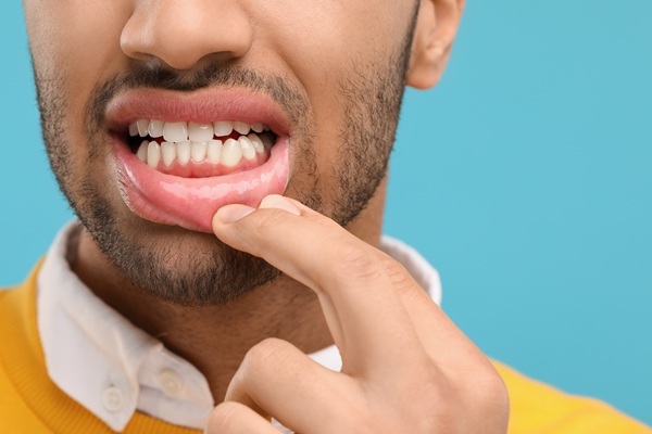 Could Gum Disease Be A Sign Of Another Condition?