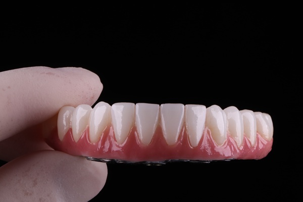 When Are Implant Supported Dentures Recommended?